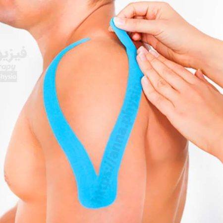 فواید استفاده از تیپ در فیزیوتراپی
تیپ به شکل حرف (Y) لاتین
تیپ به شکل (Y) چه کاربردی دارد :

این نوع از تیپ زدن به شکل تیروکمان در موارد زیر کاربرد دارد :

مهار یا تسهیل محرک های عضلانی
احاطه کردن عضله هدف