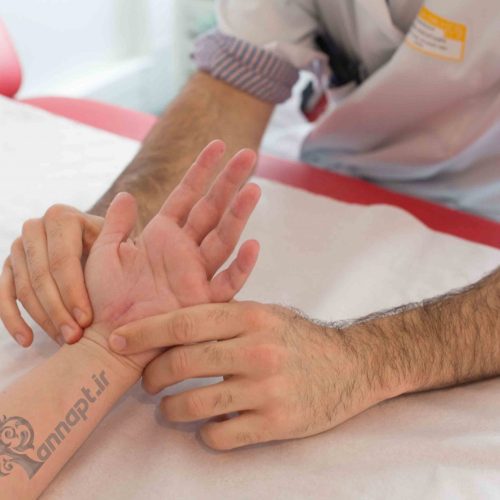 در بخش ذیل تعدادی از اختلالات مچ دست را به اختصار بررسی می کنیم :

تغییر بیومکانیک مفصل مچ دست
سندروم تونل کارپال (CTS)
شکستگی مچ دست یا شکستگی کالیس
دفورمیتی های مفصلی در بیماری آرتریت روماتوئید
