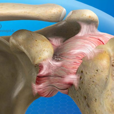 شانه یخ زده ، frozen shoulder ، فیزیوتراپی شانه ، شانه یخ زده ، frozen shoulder ، فیزیوتراپی شانه ،