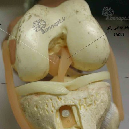 رباط صلیبی چیست؟
رباط صلیبی کجا قرار دارد؟
متقاطع به معنای صلیبی شکل است که بیانگر شکل فضایی آنها هنگام عبور از درون بریدگی بین کندیل های استخوان ران است. هردو لیگامان قدامی و خلفی ضخیم و قوی هستند که نشان دهنده نقش مهم آن در ایجاد ثبات برای زانو است.